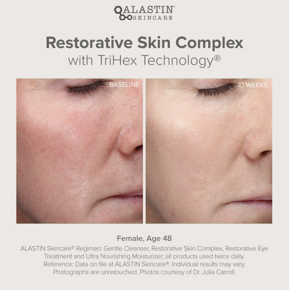 Restorative Skin Complex 29.6ml