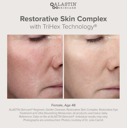 Restorative Skin Complex 29.6ml